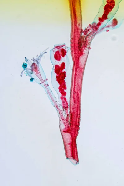 Hydra Cnidaria Cinsi Hydrozoa Sınıfı Eğitim Için Mikroskop Altında Bulunan — Stok fotoğraf