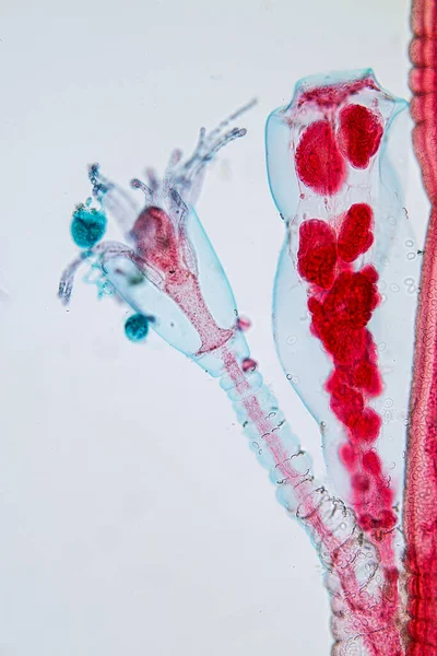 Hydra, Cnidaria cinsi ve Hydrozoa sınıfı eğitim için mikroskop altında bulunan küçük, tatlı su hayvanlarından oluşan bir cinstir..