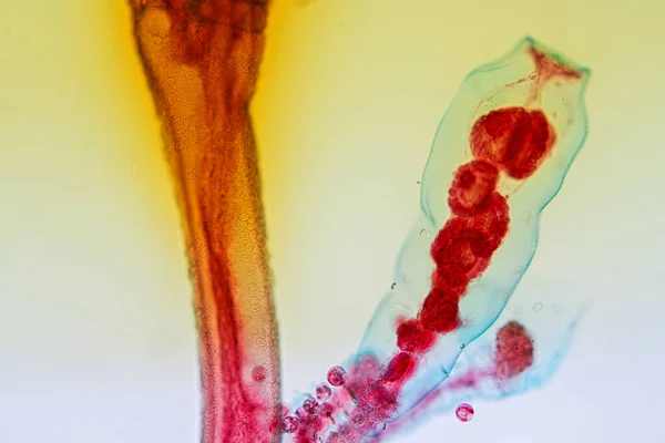 Hydra Genus Small Fresh Water Animals Phylum Cnidaria Class Hydrozoa — Stock Photo, Image
