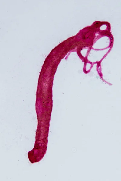 Hydra Род Мелких Пресноводных Животных Типа Cnidaria Класса Hydrozoa Микроскопом — стоковое фото