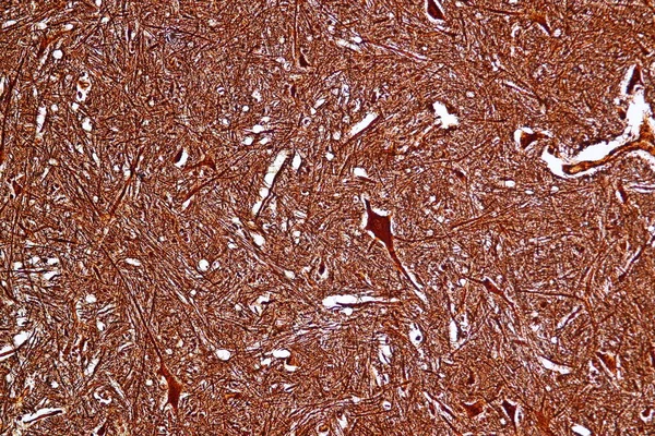 Neuron Motor Pilhas Nervo Sob Microscópio Laboratório — Fotografia de Stock