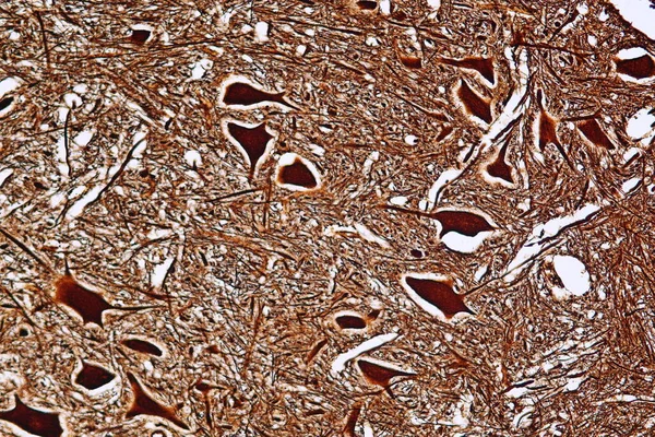 Motor Neuron Nervové Buňky Pod Mikroskopem Laboratoři — Stock fotografie