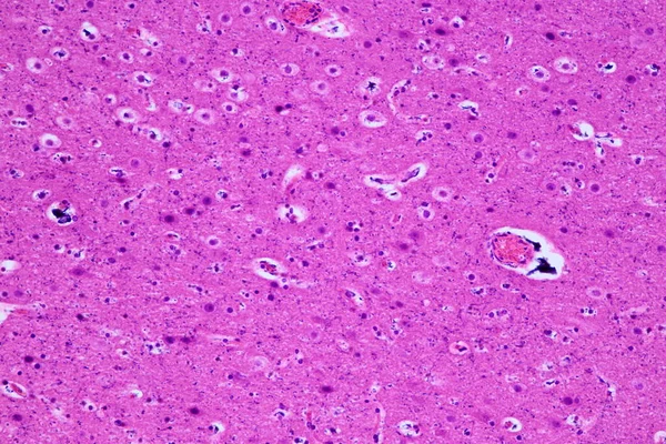 Моторные Нейроны Нервные Клетки Микроскопом Лаборатории — стоковое фото