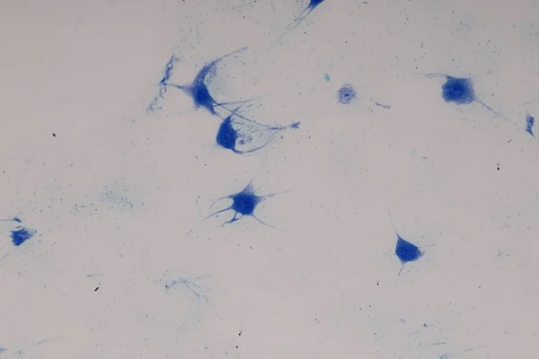 Neurón Motor Células Nerviosas Bajo Microscopio Laboratorio — Foto de Stock