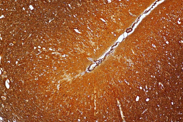 Neurone Motorio Cellule Nervose Microscopio Laboratorio — Foto Stock