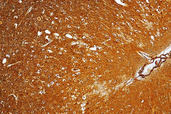 Laboratuvarda Mikroskop Altında Motor Nöron Sinir Hücreleri — Stok fotoğraf