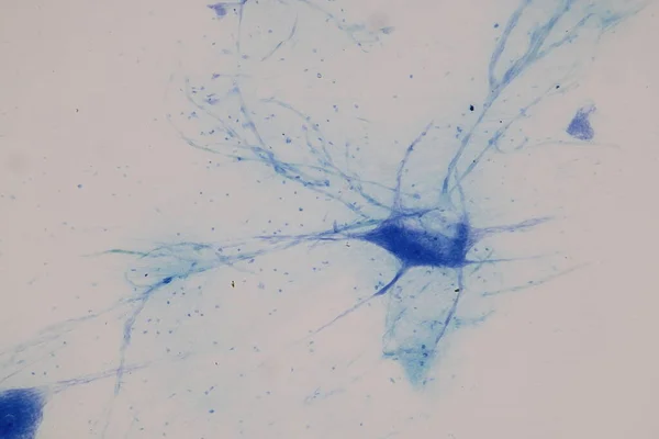 Motorneuron Och Nervceller Mikroskopet Lab — Stockfoto