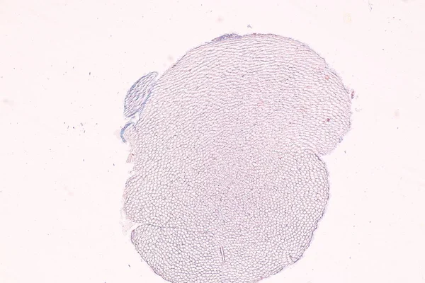 Neuron Ruchowy Komórki Nerwowe Pod Mikroskopem Laboratorium — Zdjęcie stockowe