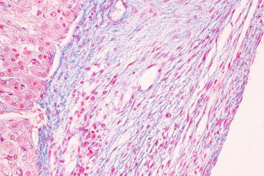 Anatomi ve Histolojik Yumurtalık, Testis ve Sperm insan hücreleri mikroskop altında.