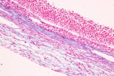 Anatomi ve Histolojik Yumurtalık, Testis ve Sperm insan hücreleri mikroskop altında.