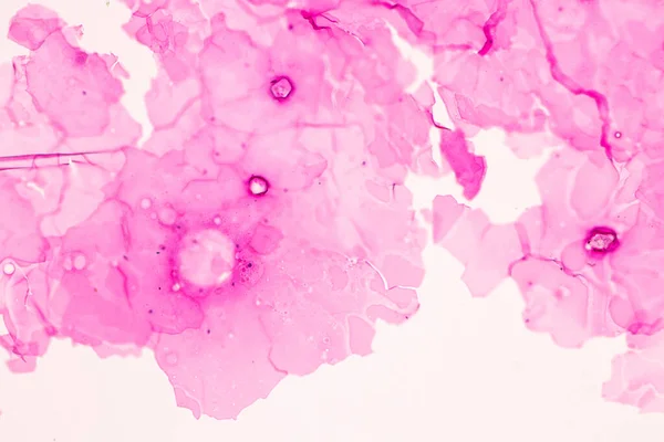 Anatómia Szövettani Petefészek Here Sperma Emberi Sejtek Mikroszkóp Alatt — Stock Fotó