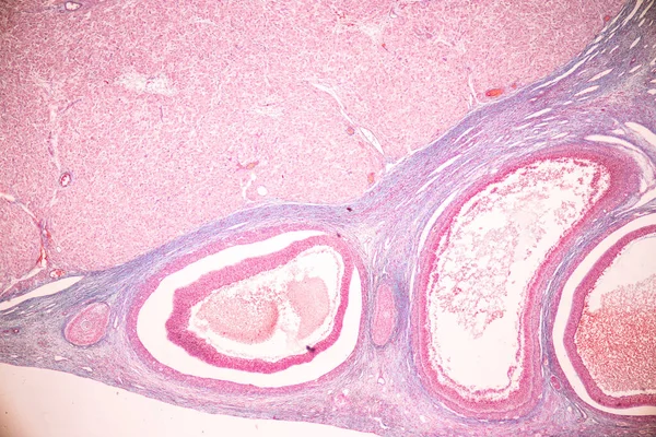 Anatomia Histologiczne Jajniki Jądra Sperma Ludzkich Komórek Pod Mikroskopem — Zdjęcie stockowe