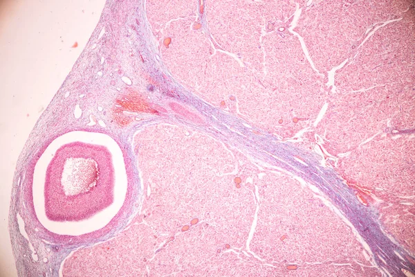 顕微鏡下での解剖学的構造と組織学的卵巣 検査および精子ヒト細胞 — ストック写真