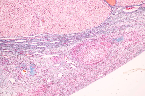 Anatomie Histologické Ovariální Testis Spermie Lidských Buněk Pod Mikroskopem — Stock fotografie