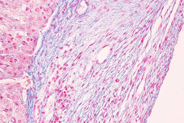 Anatomie Ovaire Histologique Testicules Spermatozoïdes Cellules Humaines Microscope — Photo