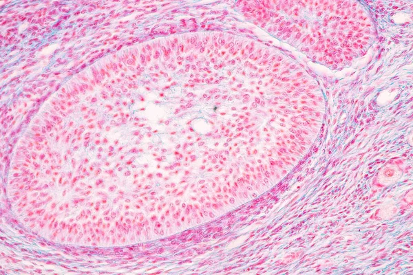 显微镜下的解剖学和组织学卵子 睾丸和精子人类细胞 — 图库照片