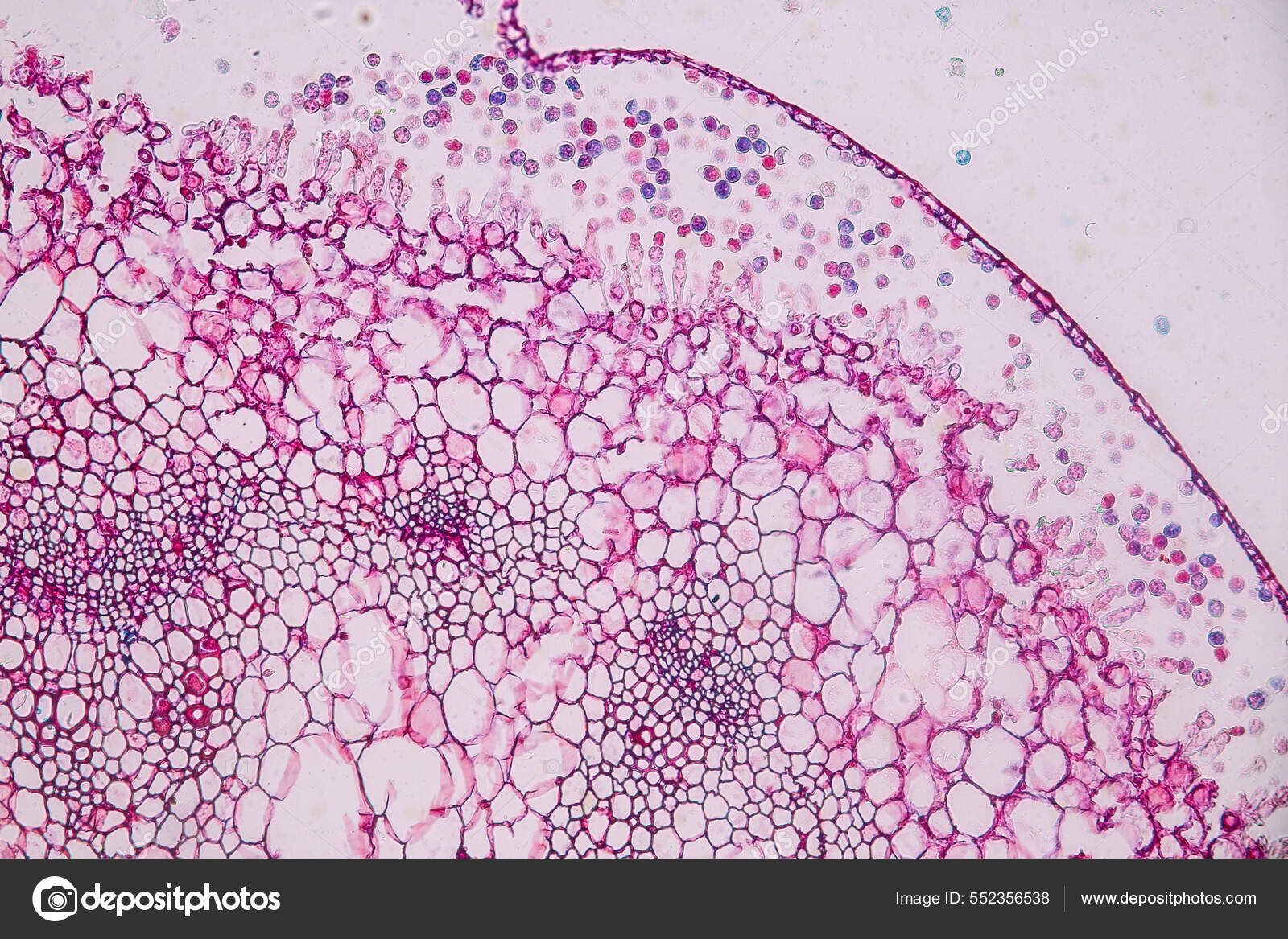 Identificación de Parásitos al Microscopio, image size:1600x1167