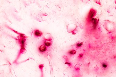 Eğitim için insan diş gelişimi mikroskop altında.