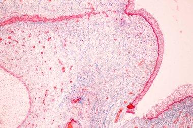 Eğitim için insan diş gelişimi mikroskop altında.