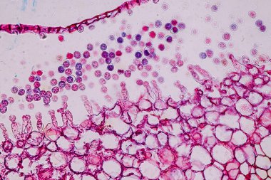 Sporlu ev sahibi hücreler (küf) eğitim için mikroskop altında odunların içindedir..