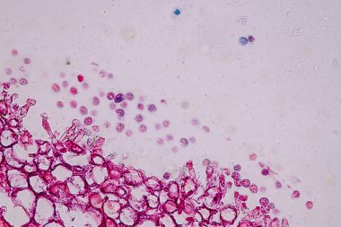 Sporlu ev sahibi hücreler (küf) eğitim için mikroskop altında odunların içindedir..