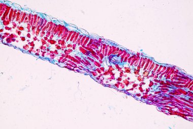 Sporlu ev sahibi hücreler (küf) eğitim için mikroskop altında odunların içindedir..