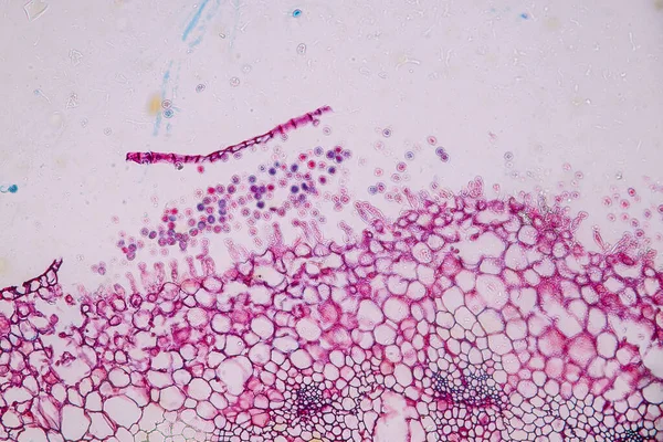 Células Hospedeiras Com Esporos Molde Estão Dentro Madeira Sob Microscópio — Fotografia de Stock