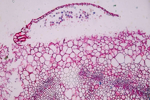 Células Hospedeiras Com Esporos Molde Estão Dentro Madeira Sob Microscópio — Fotografia de Stock