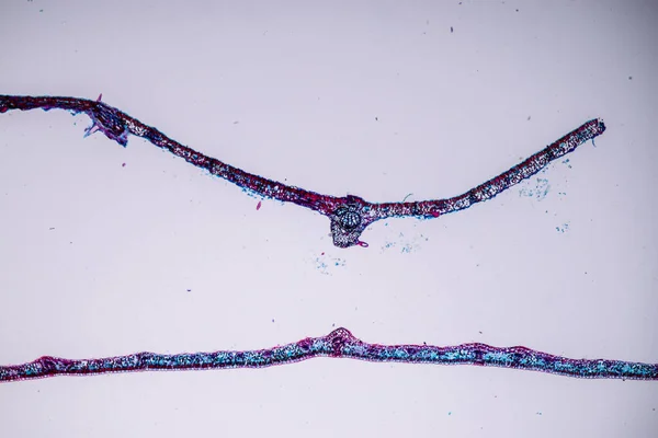 Клітини Господарі Спорами Яка Всередині Деревини Під Мікроскопом Навчання — стокове фото