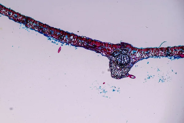 带有孢子 的宿主细胞在显微镜下接受教育 — 图库照片