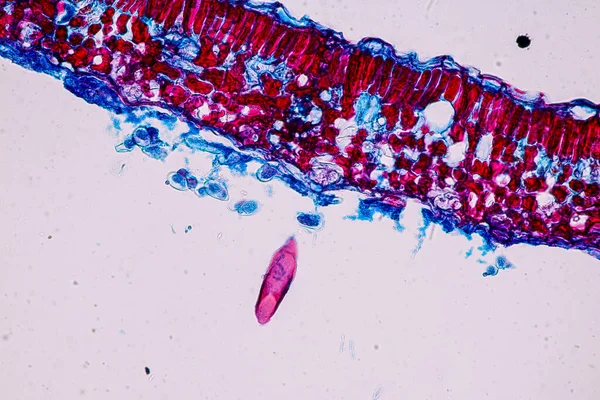 Клітини Господарі Спорами Яка Всередині Деревини Під Мікроскопом Навчання — стокове фото