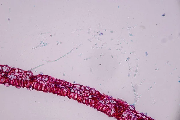 Gastheercellen Met Sporen Schimmel Bevinden Zich Hout Onder Microscoop Voor — Stockfoto