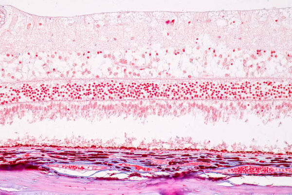 Retina human under microscope.