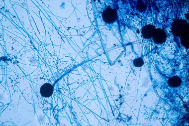 Laboratuvarda mikrobiyoloji için mikroskop altında Aspergillus niger ve Aspergillus oryzae (küf).
