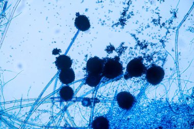 Laboratuvarda mikrobiyoloji için mikroskop altında Aspergillus niger ve Aspergillus oryzae (küf).