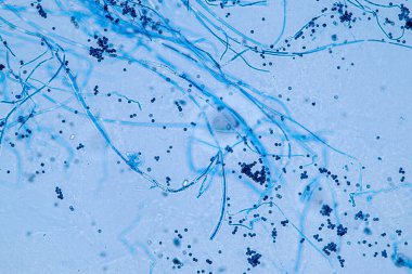 Laboratuvarda mikrobiyoloji için mikroskop altında Aspergillus niger ve Aspergillus oryzae (küf).
