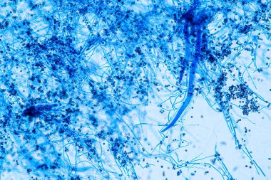 Laboratuvarda mikrobiyoloji için mikroskop altında Aspergillus niger ve Aspergillus oryzae (küf).