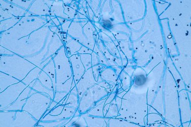 Laboratuvarda mikrobiyoloji için mikroskop altında Aspergillus niger ve Aspergillus oryzae (küf).