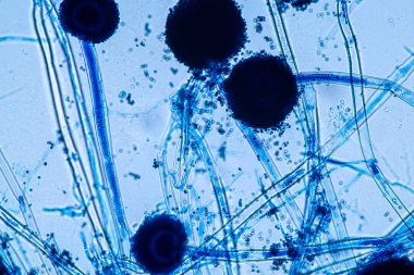 Laboratuvarda mikrobiyoloji için mikroskop altında Aspergillus niger ve Aspergillus oryzae (küf).
