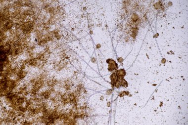 Laboratuvarda mikrobiyoloji için mikroskop altında Aspergillus niger ve Aspergillus oryzae (küf).