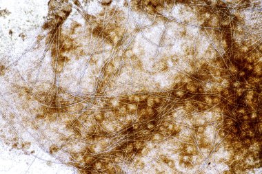 Laboratuvarda mikrobiyoloji için mikroskop altında Aspergillus niger ve Aspergillus oryzae (küf).