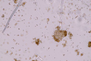Laboratuvarda mikrobiyoloji için mikroskop altında Aspergillus niger ve Aspergillus oryzae (küf).