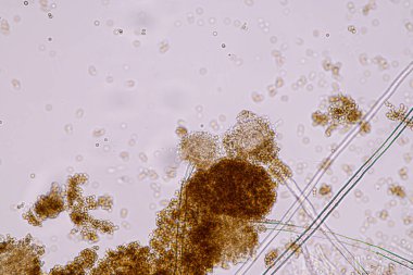 Laboratuvarda mikrobiyoloji için mikroskop altında Aspergillus niger ve Aspergillus oryzae (küf).