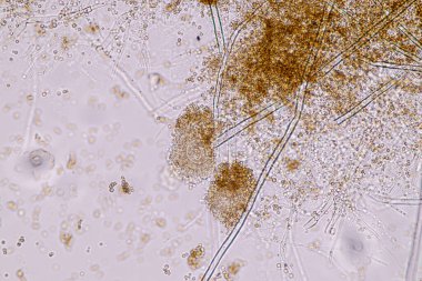 Laboratuvarda mikrobiyoloji için mikroskop altında Aspergillus niger ve Aspergillus oryzae (küf).