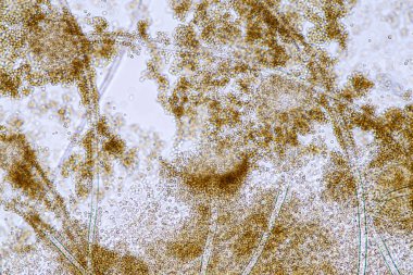 Laboratuvarda mikrobiyoloji için mikroskop altında Aspergillus niger ve Aspergillus oryzae (küf).