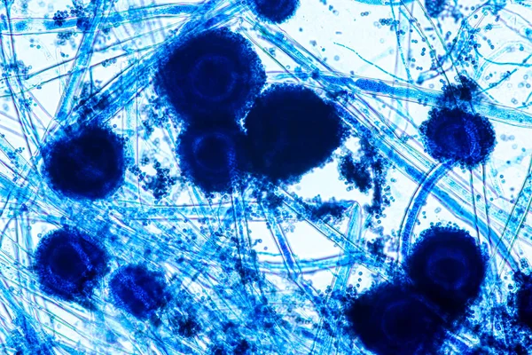 Aspergillus Niger Aspergillus Oryzae Mofo Sob Microscópio Para Microbiologia Laboratório — Fotografia de Stock