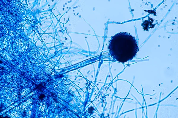 Aspergillus Niger Und Aspergillus Oryzae Schimmelpilz Unter Dem Mikroskop Für — Stockfoto