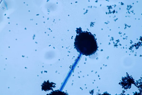 Aspergillus Niger Och Aspergillus Oryzae Mögel Mikroskop För Mikrobiologi Lab — Stockfoto