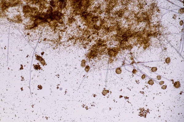 Aspergillus Niger Aspergillus Oryzae Penész Mikrobiológiai Mikroszkóp Alatt Laborban — Stock Fotó