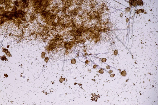 实验室微生物显微镜下的黑曲霉和曲霉 — 图库照片